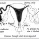 Illustration for article titled Hysterosalpingogram
